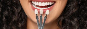 Mansfield, TX, dentist offers teeth whitening