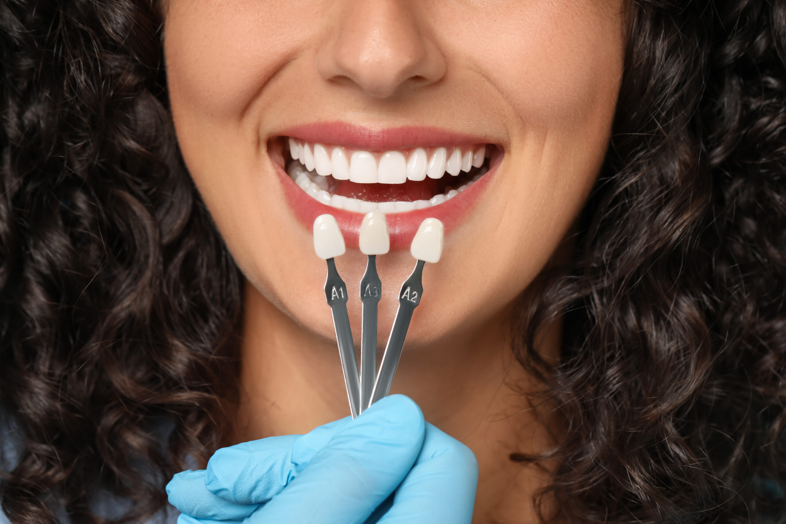 Mansfield, TX, dentist offers teeth whitening 