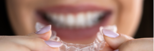 Mansfield, TX, dentist offers clear aligners