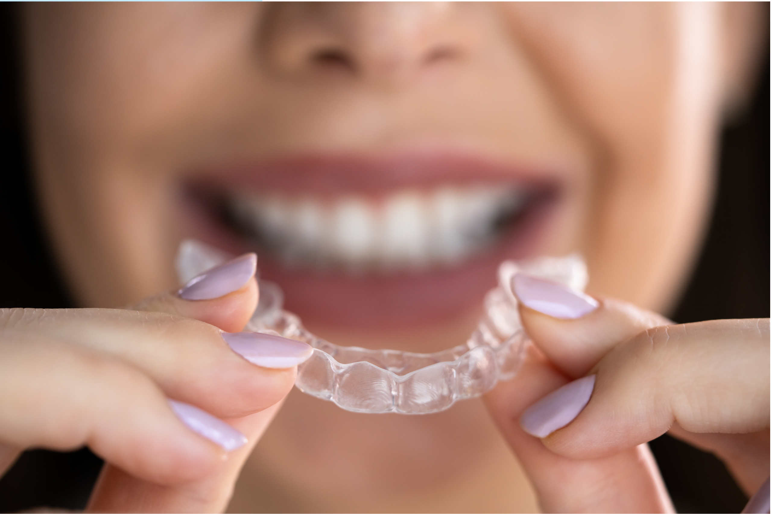 Mansfield, TX, dentist offers clear aligners 