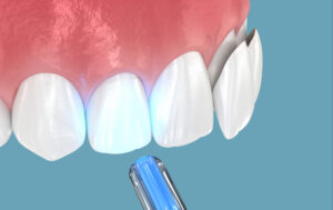 mansfield restorative dentistry